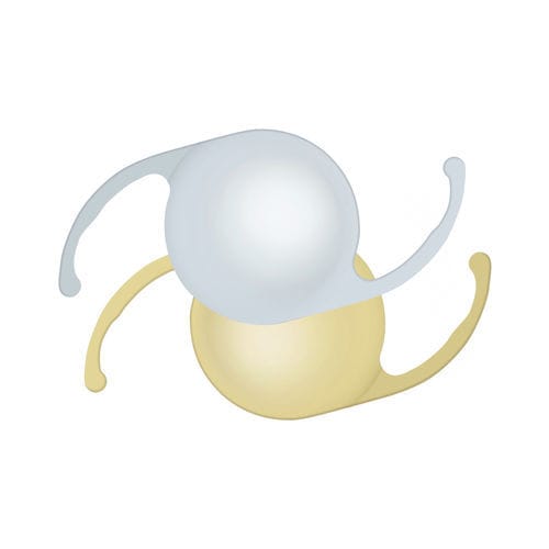 Lente intraoculare monofocale - Precisal P302AC - Ophtec