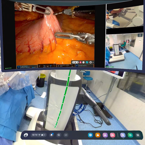 Sistema video per sala operatoria 4K - mSurgery - mSurgery - MP4 / MPEG / AVI