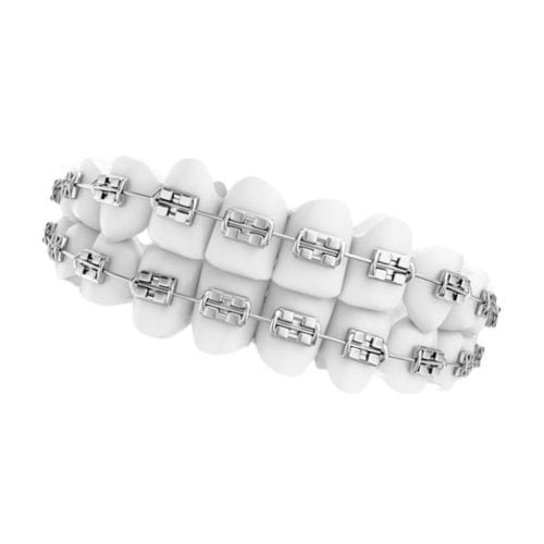 Bracket ortodontici in metallo - ALA-BS - Alamere Medical Corporation - estetico