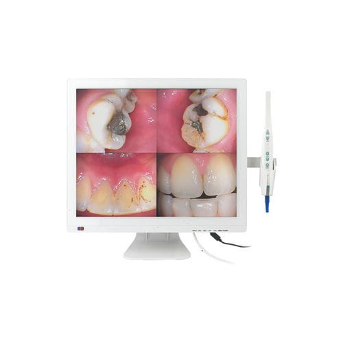 Fotocamera intraorale - M-978V - Chuan Fu Medical Instrument Co., Ltd. - digitale / CMOS