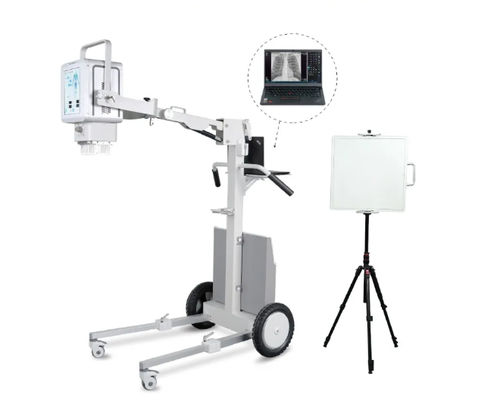 sistema di radiografia digitale - YSENMED