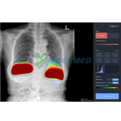 Software medico - YSX-AI-C - YSENMED - per diagnostica per immagini / per radiologia / clinico