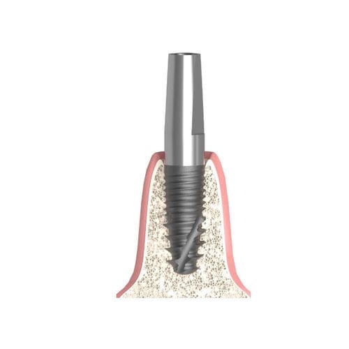 Pilastro dentale per impianto cilindrico conico - Actival - Bionika Medline Kft. - in titanio / interno / dritto