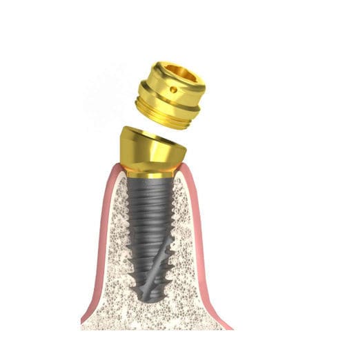 Pilastro dentale per impianto cilindrico conico - Actival - Bionika Medline Kft. - conico / interno / a vite