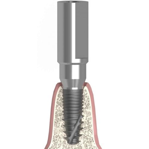 Bodyscan intraorale - UNIFORM SIC® ace® max® - Bionika Medline Kft. - in metallo