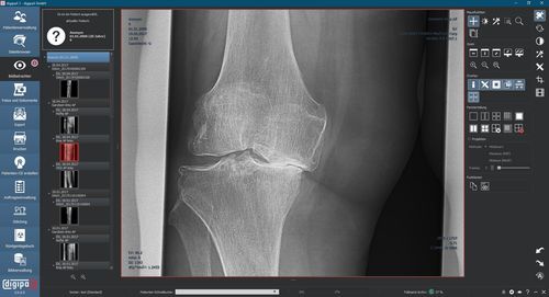 PACS per diagnostica per immagini - digipaX GmbH