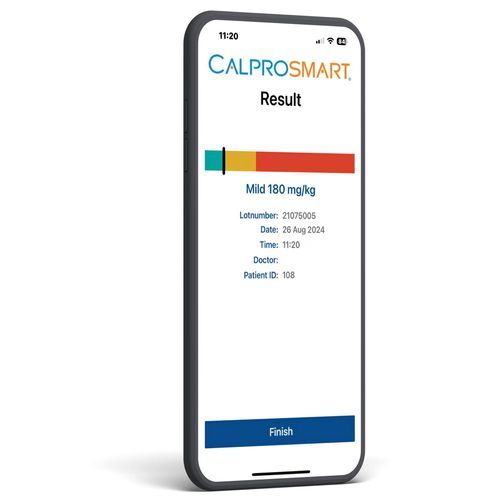 Analizzatore POC per malattie infiammatorie intestinali - CalproSmart Office - Calpro AS - a immunoanalisi / a flusso laterale / della calprotectina