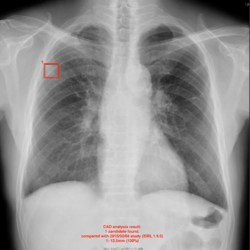 Software intelligenza artificiale - EIRL - LPIXEL Inc. - clinico / per radiologia / per endoscopia
