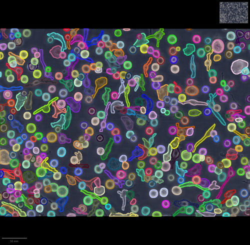 Software intelligenza artificiale - IMACEL - LPIXEL Inc. - per imaging cellulare / d'imaging macroscopico di patologia / per la ricerca farmaceutica