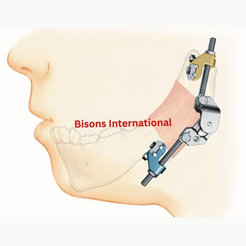 Distrattore mascellare - BI-001477 - Bisons International - cranico / esterno / per adulti