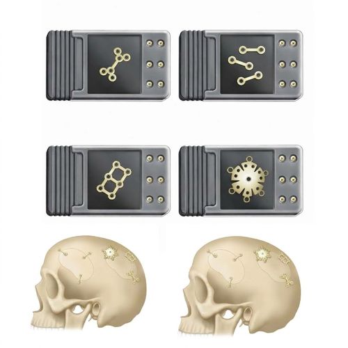 Impianto per gamba - BI-002183 - Bisons International - anatomico / in cobalto-cromo