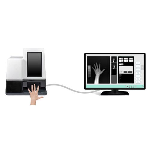Sistema di radiografia digitale - MedAlliance Inc. - per radiografia delle articolazioni / per radiografia pediatrica