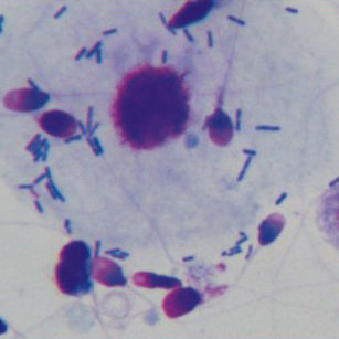Kit di reagenti colorante - Wuhan Jinhong Biotech Development Co., Ltd. - per citologia / per analisi di sperma