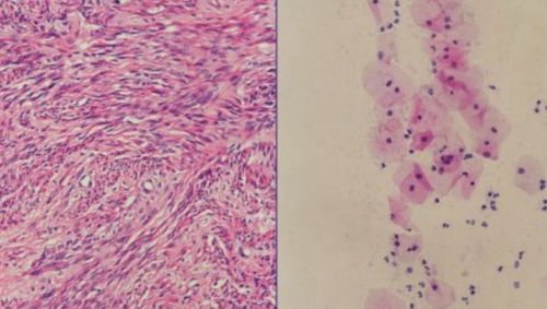 Kit di reagenti ematossilina di Harris - H-E stain - Wuhan Jinhong Biotech Development Co., Ltd. - per istopatologia