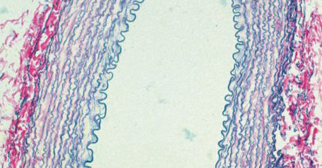 Kit di reagenti colorante - BA4083A - Wuhan Jinhong Biotech Development Co., Ltd. - per istopatologia / da laboratorio / diagnostico