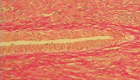 Kit di reagenti colorante - BA4084A - Wuhan Jinhong Biotech Development Co., Ltd. - per istopatologia