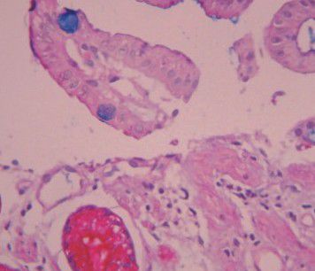 Kit di reagenti colorante - Wuhan Jinhong Biotech Development Co., Ltd. - per istopatologia