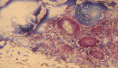 Kit di reagenti colorante - BA4088A - Wuhan Jinhong Biotech Development Co., Ltd. - per istopatologia
