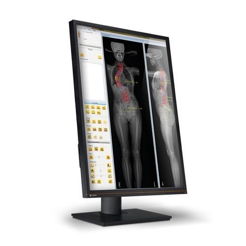 Software di modelizzazione - EOS IMAGING - di trattamento / di pianificazione / medico