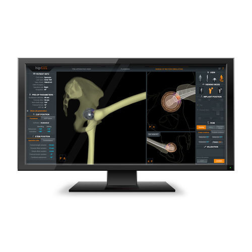 Software medico - EOSapps - EOS IMAGING - di anatomia / per radiologia / chirurgico