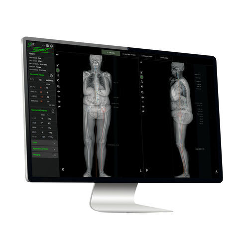 Piattaforma AI per il settore medico - EOS IMAGING - per diagnostica per immagini / di quantificazione / di apprendimento automatico
