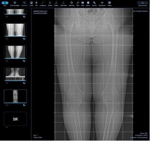 Modulo software per radiologia - Orthogrid - G-Squared - di analisi delle immagini / di misura / corpo