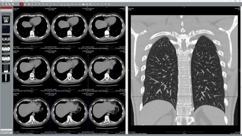 Software di visualizzazione DICOM - EyeLite - G-Squared - medico / di teleconsultazione / Windows