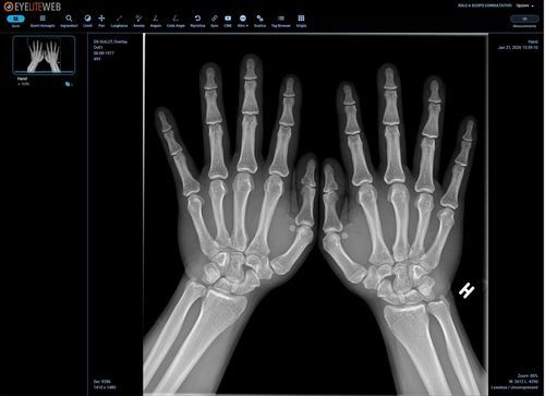 modulo software di visualizzazione DICOM - G-Squared