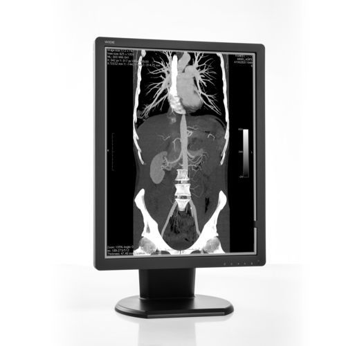 Monitor diagnostico - MX30N - Wide USA Corporation - per diagnostica per immagini / 2048 x 1536 / 21.3"