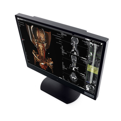 Monitor diagnostico - CW60N - Wide USA Corporation - per diagnostica per immagini / 30" / LCD
