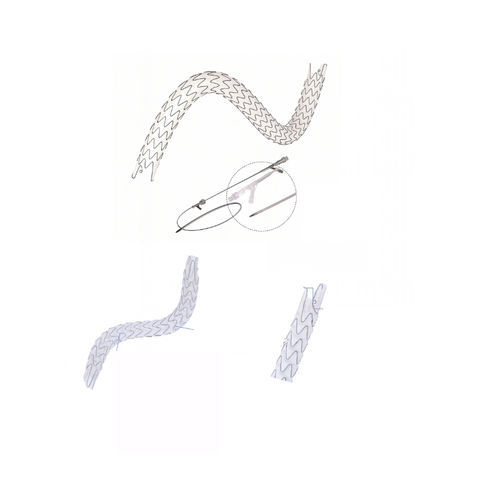 Stent ureterale - EUS0919514 - Hunan Endovascular Device Co., Ltd. - in nitinol / con rivestimento