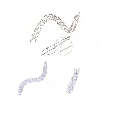 Stent ureterale - EUS series - Hunan Endovascular Device Co., Ltd. - in nitinol / polimerico / autoespandibile