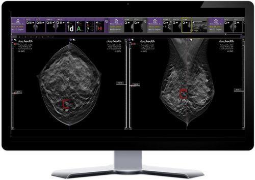 Piattaforma AI per ospedali - DeepHealth - per diagnostica per immagini / di apprendimento automatico / visualizzatore