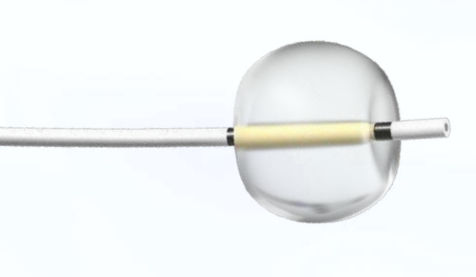 Catetere per estrazione di calcoli - Focuz Medical - biliare / con palloncino