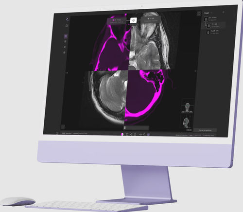Software medico - zap-axon - ZAP Surgical Systems Inc - di progettazione / di trattamento / di pianificazione