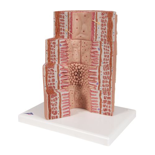 Modello anatomico di stomaco - K23 - 3B Scientific   - di intestino tenue / ad uso didattico
