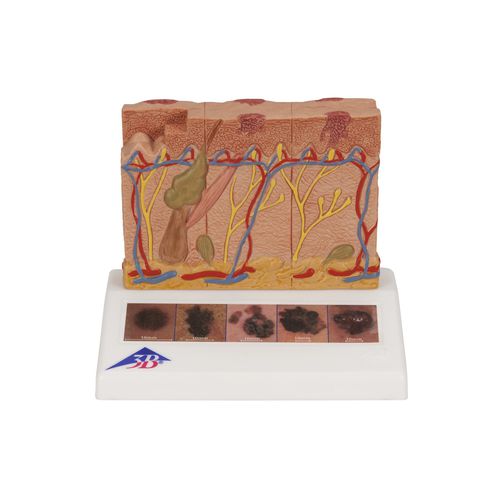 Modello anatomico di pelle - J15 - 3B Scientific   - ad uso didattico / oncologico