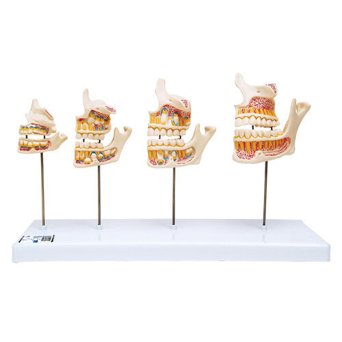 Modello anatomico di mandibola - D20 - 3B Scientific   - di denti / ad uso didattico