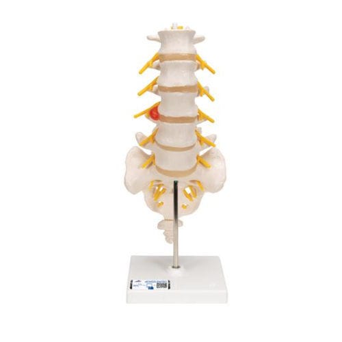 Modello anatomico di colonna vertebrale lombare - A76/5 - 3B Scientific   - di osso sacro / ad uso didattico