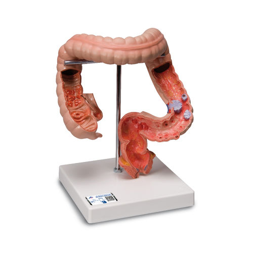 Modello anatomico intestino crasso - K55 - 3B Scientific   - ad uso didattico