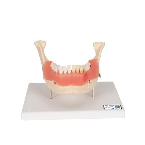 Modello anatomico di mandibola - D26 - 3B Scientific   - di denti / ad uso didattico