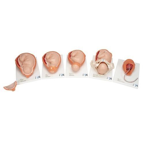 Modello anatomico di utero - VG392 - 3B Scientific   - ad uso didattico / femminile