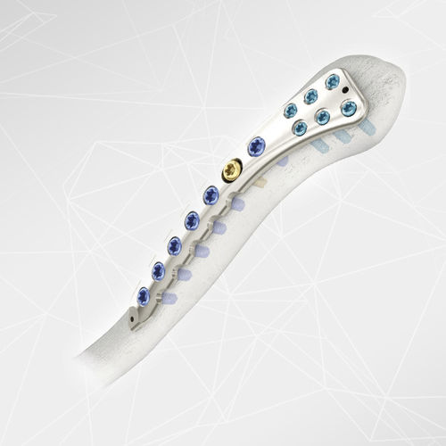 Placca di compressione per clavicola - LOQTEQ® 2.7 - aap Implantate - laterale / bloccata / in metallo