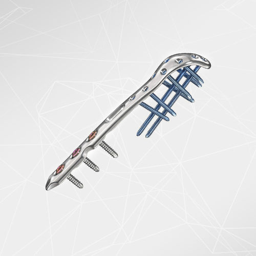 Placca di compressione per olecrano - LOQTEQ® 2.7 - aap Implantate - bloccata / in metallo