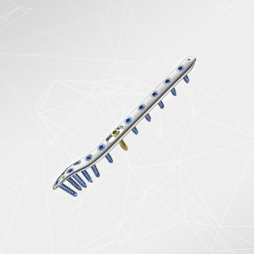 Placca di compressione per fibula -  LOQTEQ® 3.5 - aap Implantate - distale / laterale / bloccata
