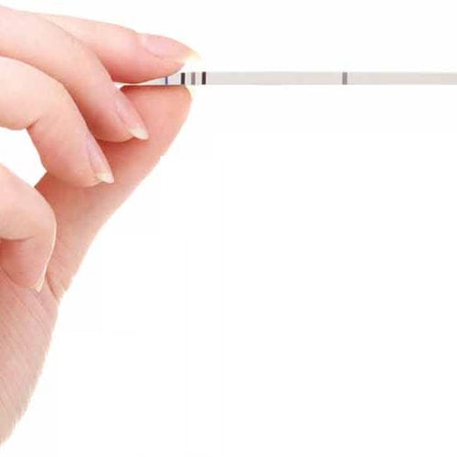 Kit di test per genotipizzazione - 03-35A-20 series - AB Analitica  - del papillomavirus umano / per PCR / striscia reattiva