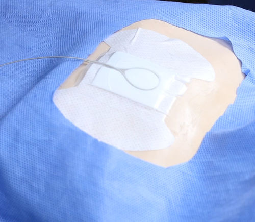 Fissatore per catetere intravenoso - Lock Plus - ACE Medical   - per busto / adesivo