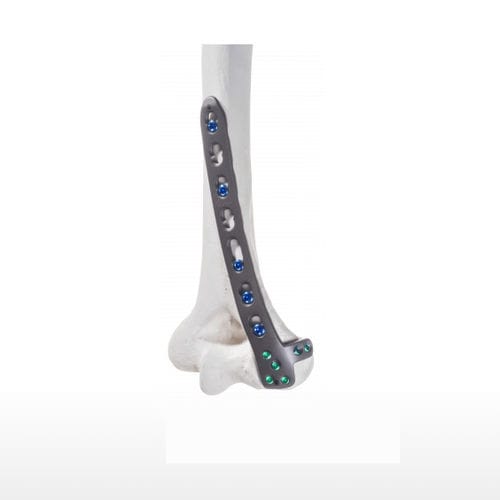 Placca di compressione per omero - 10-54183 - AF Medical   - distale / laterale / mediale