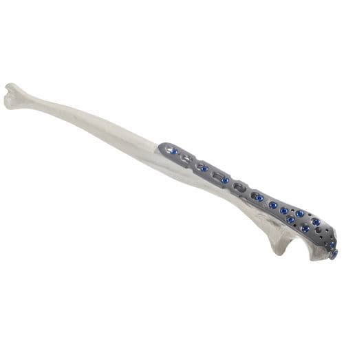 Placca di compressione per olecrano - 10-54322 - AF Medical   - bloccata / in metallo