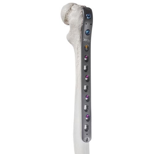 Placca di compressione per femore - 10-63014 - AF Medical   - per trocantere / prossimale / bloccata